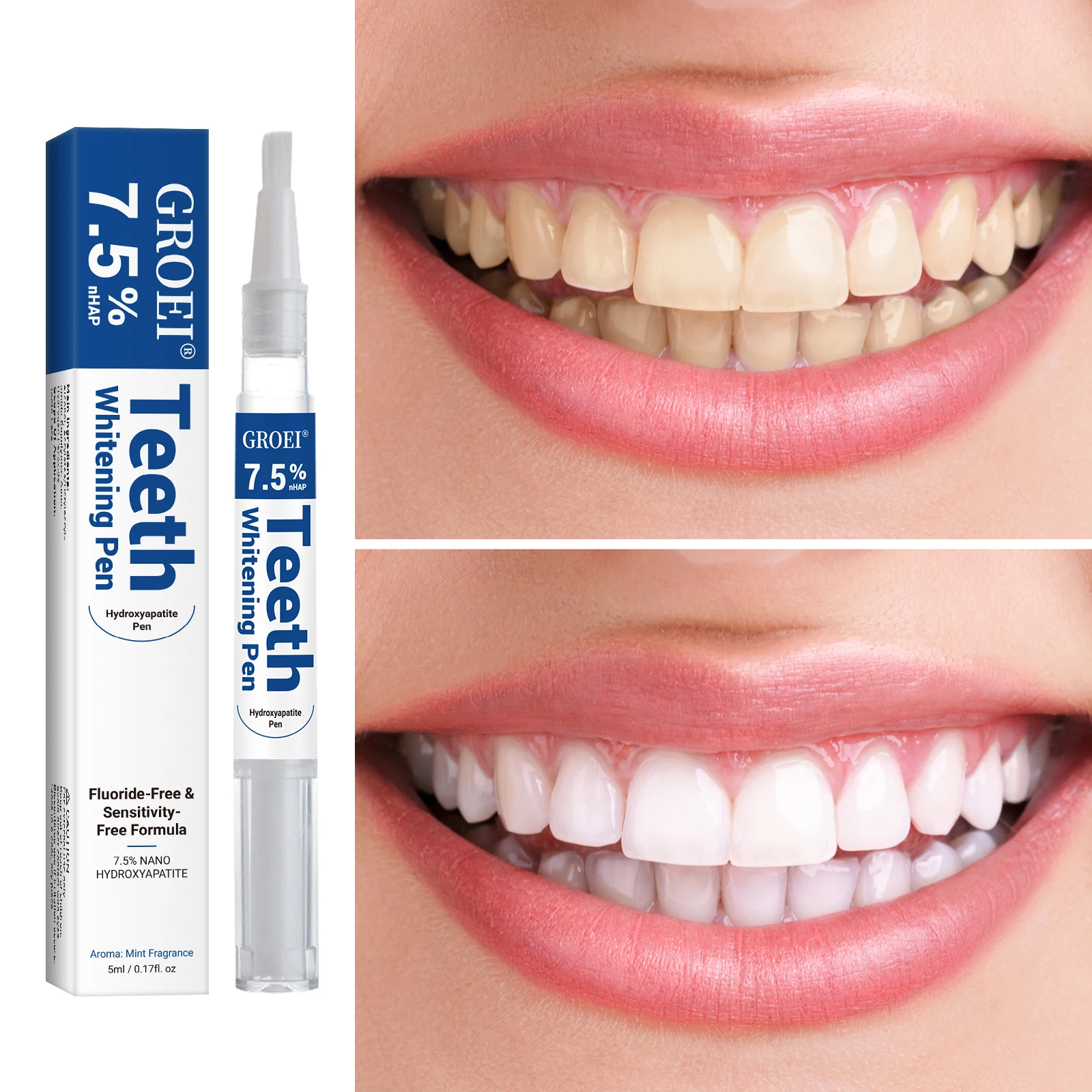 Hydroxyapatite Tand Whitening  - Teeth Whitening Price recensie en prijs