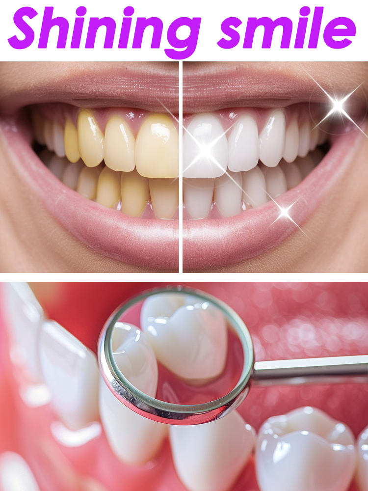 GlorySmile Tanden Whitening Fr - Teeth Whitening Xylitol recensie en prijs