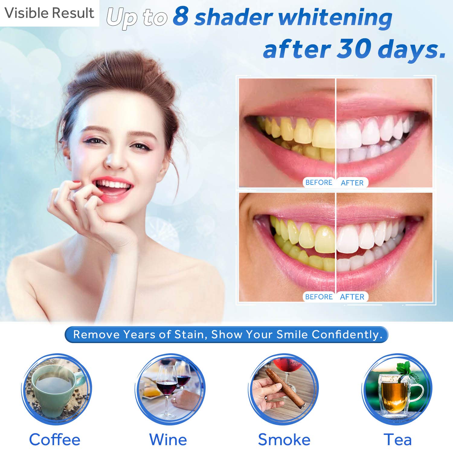 Tanden Whitening Gel Refill Sp - Teeth Whitening Kit recensie en prijs