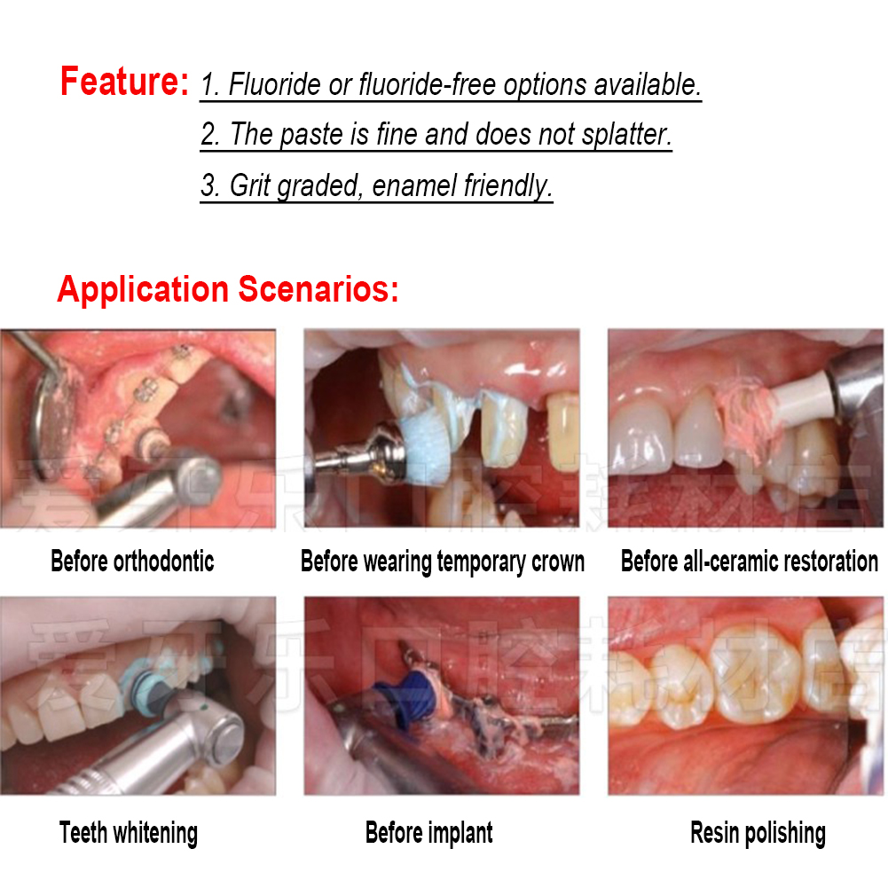 Ivoclar Vivadent Mondtandpoets - Teeth Whitening Xylitol recensie en prijs