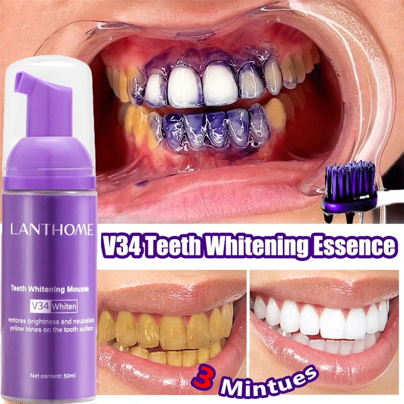 V34 Tanden Whitening Mousse Ta - Teeth Whitening Xylitol recensie en prijs