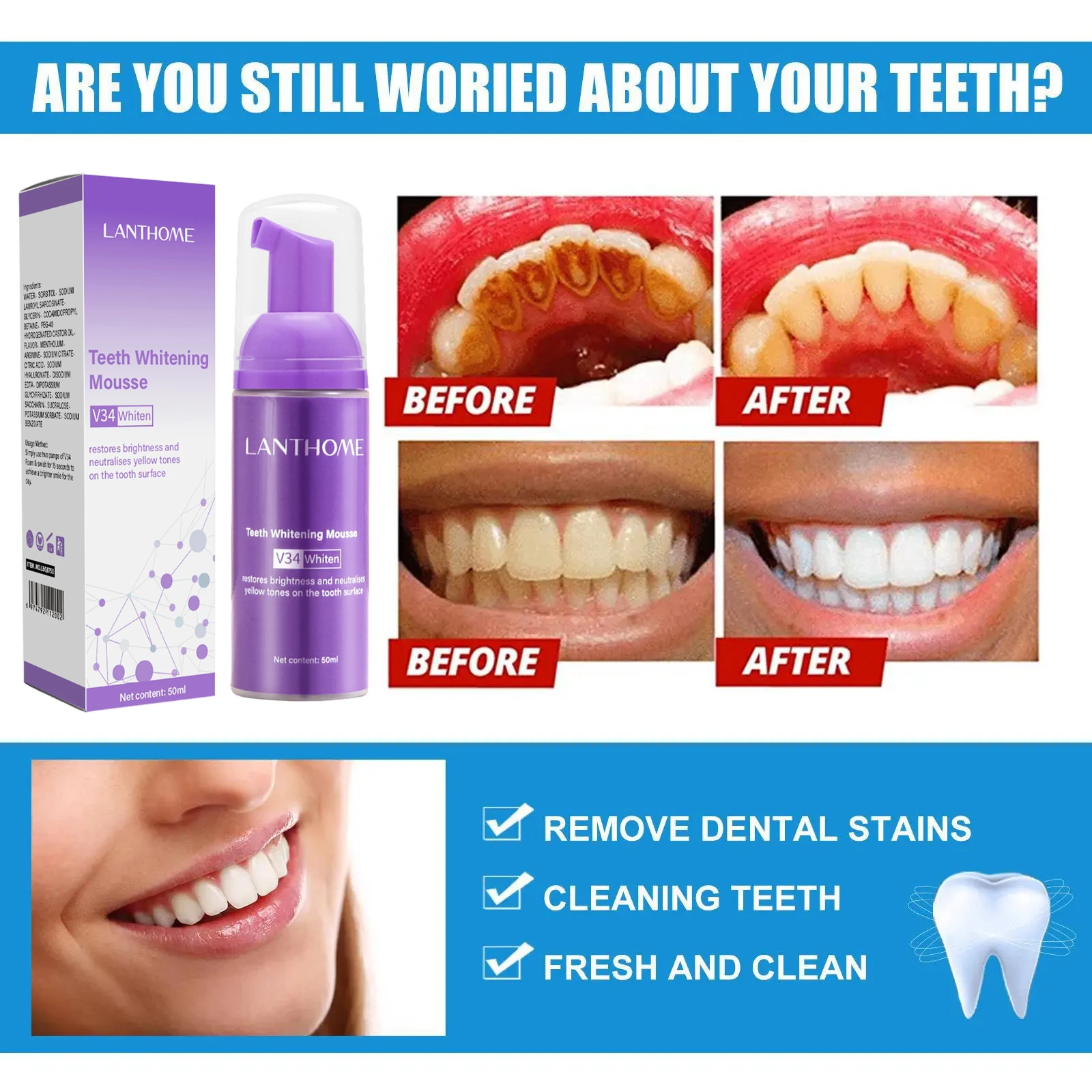 V34 Tanden Whitening Mousse Ta - Teeth Whitening Xylitol recensie en prijs