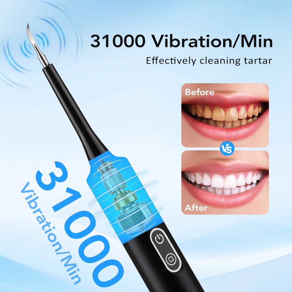 Elektrische sonische vibratie  - Teeth Whitening Express recensie en prijs