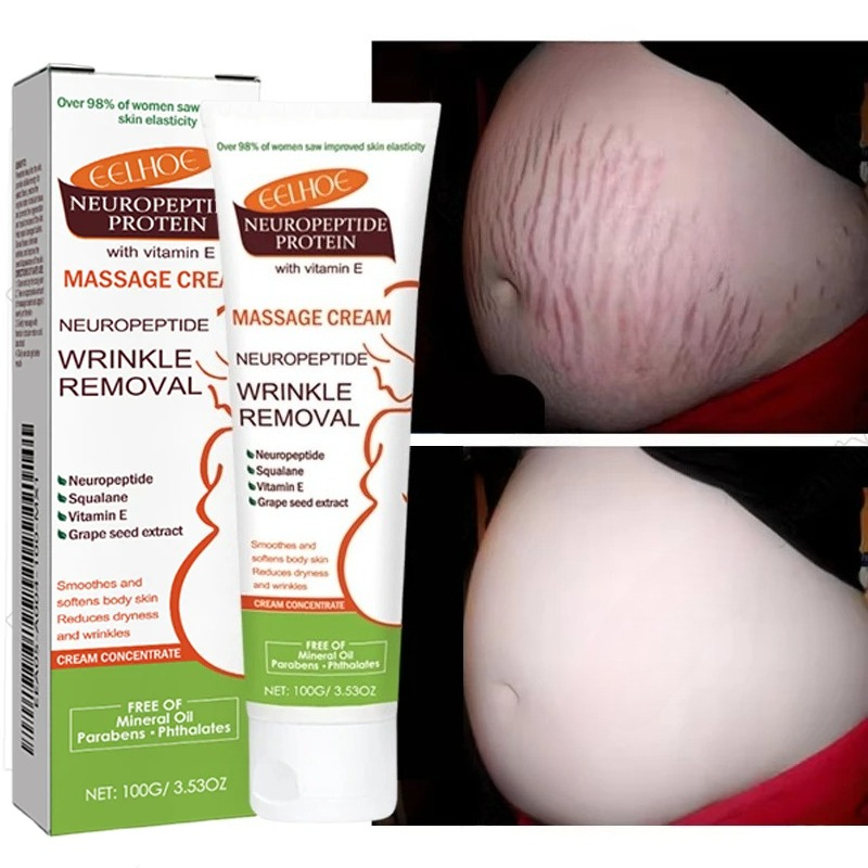 100g Striae Permanente Verwijd - Teeth Whitening Pregnancy recensie en prijs
